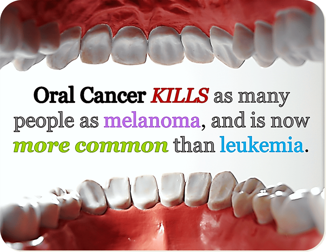 presentation of oral cancer